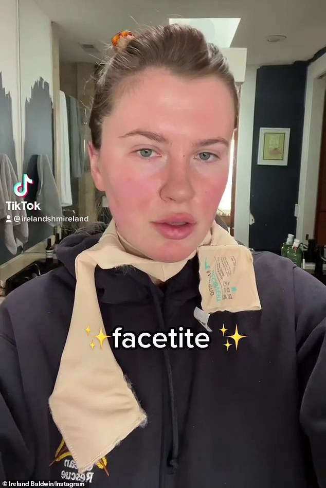 Photo of Ireland Baldwin erklärt, warum sie sich im Alter von 26 Jahren einem „Mini-Facelifting“ unterziehen musste