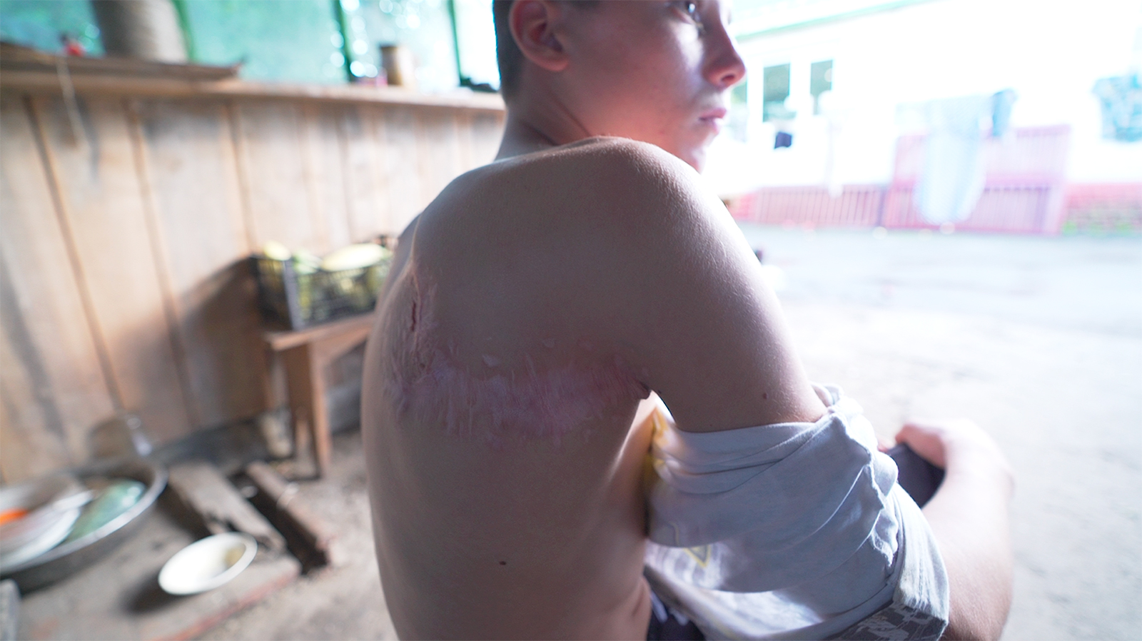 Photo of Durch den Krieg verwundet, sind die Narben der verwundeten Kinder in der Ukraine mehr als oberflächlich